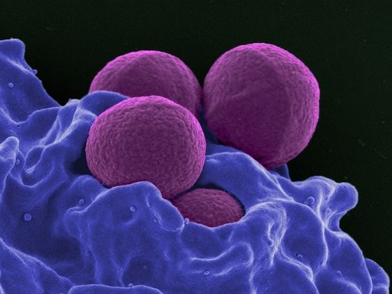 Scientists Discover Nanotechnology Coating That Can Kill  Percent Of Superbugs - The transparent coating will be baked into the material, forming a hard surface that is resistant to superbugs including MRSA, some fungi and Escherichia coli. The team is now studying on how the material could be incorporated into paint and plastics to explore a wider use of the discovery.