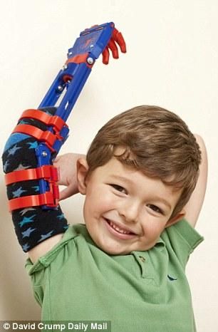 E-Nable Designs Young UK Child a new Superhero-inspired 3D Printed Arm | FILACART BLOG | 3D Printing MegaStore 