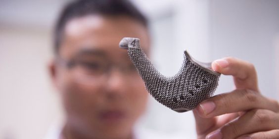 Xi’an Particle Cloud's awesome 3D bone printing technology - Tech Insider
