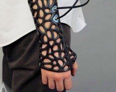 Osteoid 3D Printed Cast, Deniz Karahasin Osteoid, 3d printed cast, ultrasound cast, sound healing, bone healing, medicine devices, medicine ...