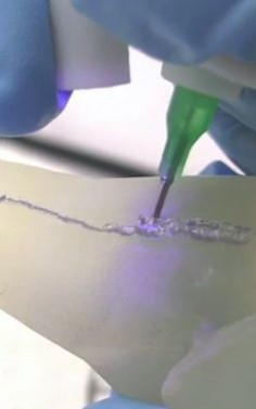 This Pen 3-D Prints Live Cells On A Damaged Bone | A new "bio pen" will allow surgeons to "draw" layers of cells on damaged bones and cartilage during surgery. This will help cells multiply and heal the injured spot by growing into nerves, muscle, and bone.