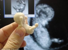 3D print your 3D ultrasound!