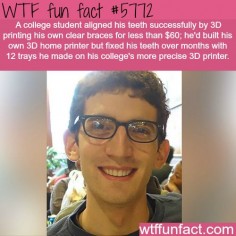 College student 3D prints his own braces - WTF fun facts